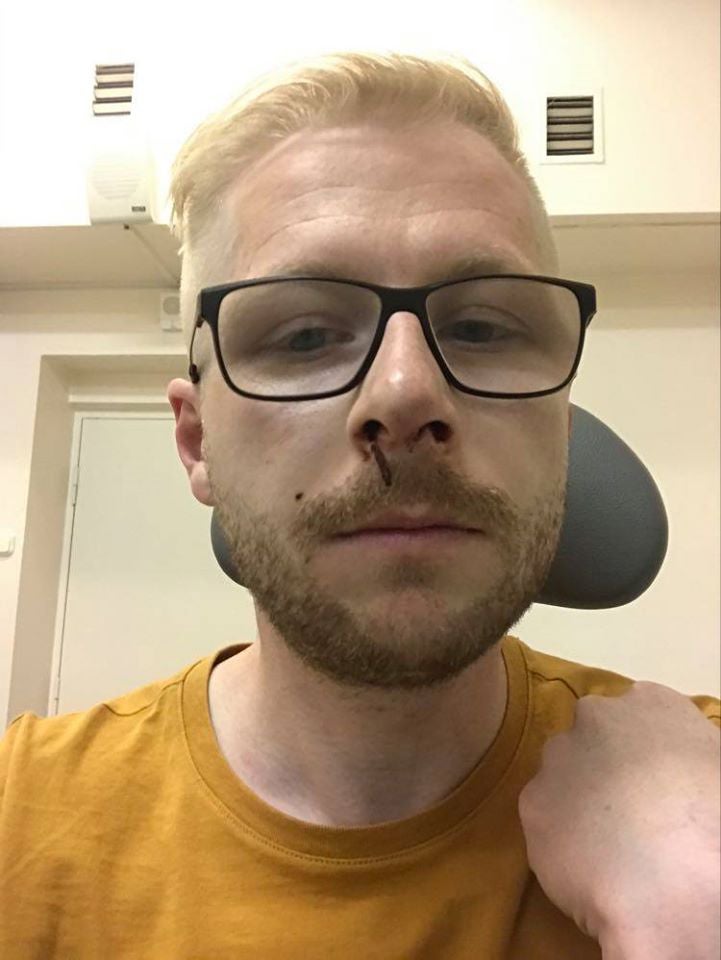 Selfie of Anton Trofimovich taken at the hospital, after his release from custody. July 2020.