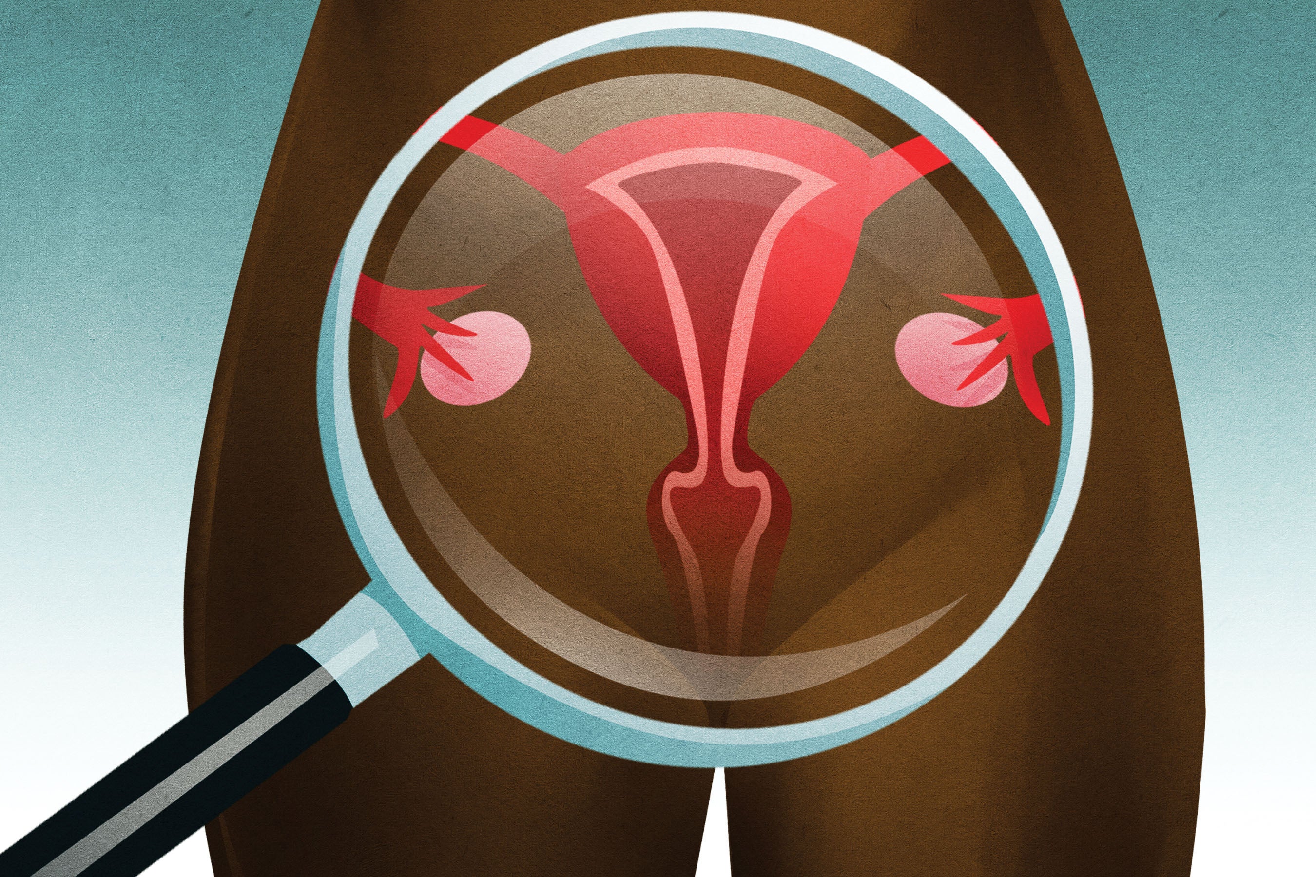 202201us_georgia_cervicalcancer_screening_illustration