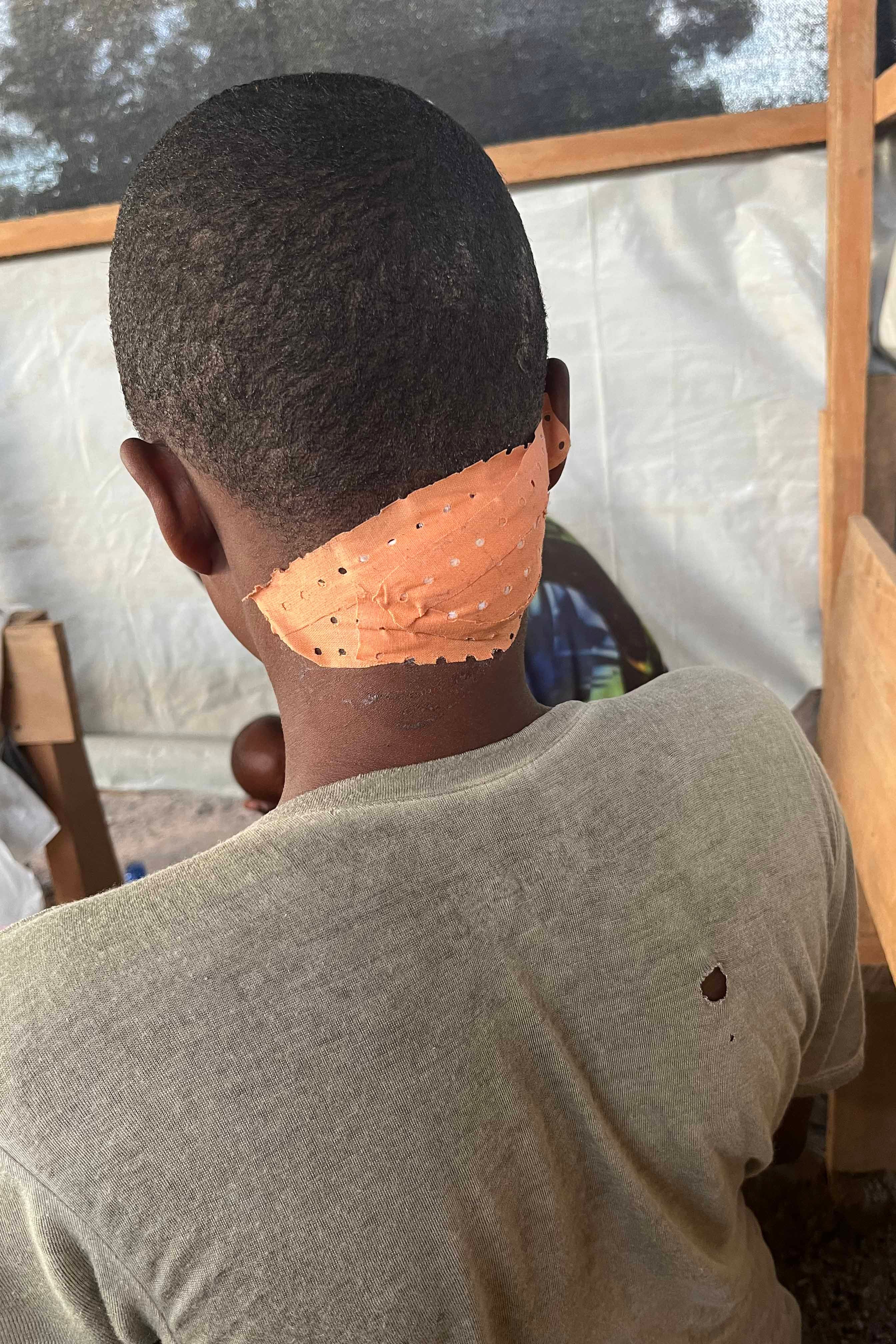 A woman shows her wounds