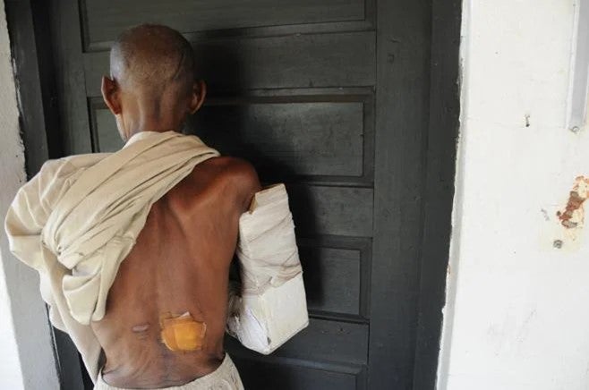 Les blessures d'une victime des attaques du 1 février 2014 des anti-balaka sur Guen.