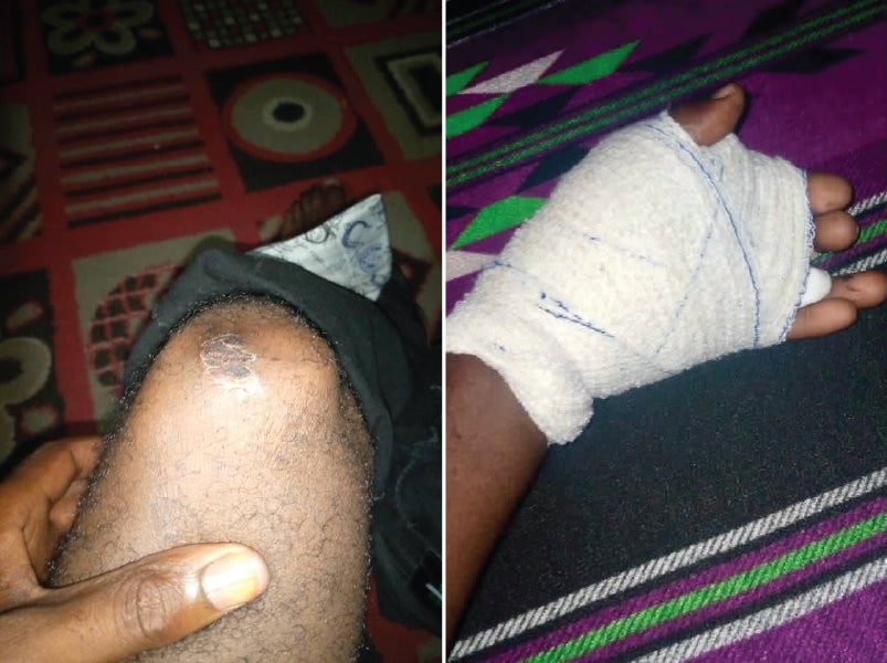 side-by-side photos of a wounded knee and hand