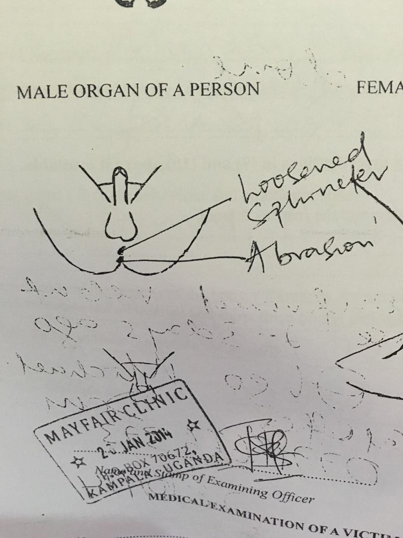 anal exam from Uganda 