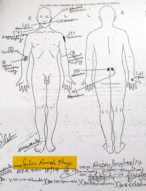 Copy of post-mortem report of Sachin Dhage, February 21, 2014.