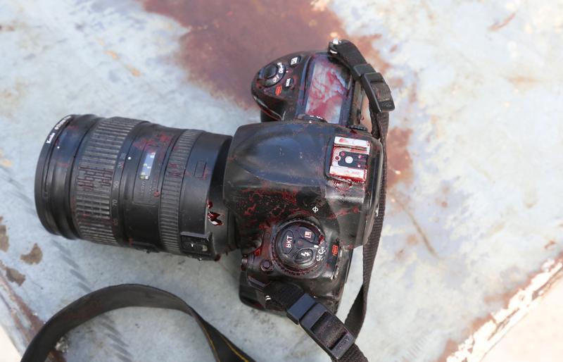 The blood stained camera of a photojournalist is seen after a secondary explosion in front of Dayah hotel in Somalia's capital Mogadishu, January 25, 2017.