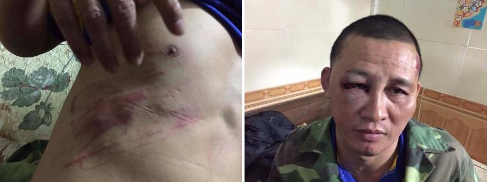 Nguyễn Công Huân sau khi bị hành hung ở Nghệ An ngày mồng 2 tháng Hai năm 2016.