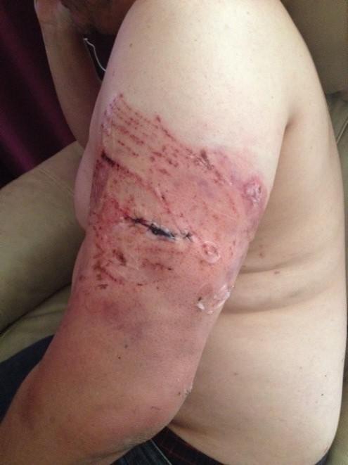 201909US_Tulsa_policing_dogbite1