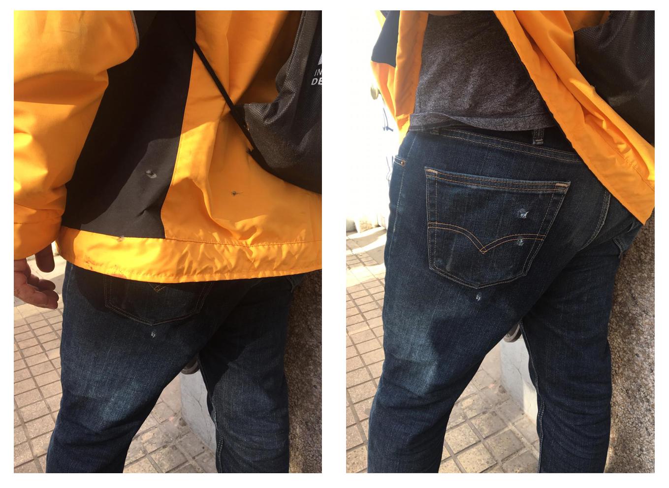 Jorge Ortiz was hit by six pellets from behind despite wearing the Institute’s team widely recognized yellow jacket and helmet. 