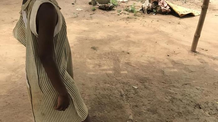 This girl was among 16 people with real or perceived mental health conditions released from shackles in Nyakumasi Prayer Camp, in Central Region, Ghana, on June 30, 2017