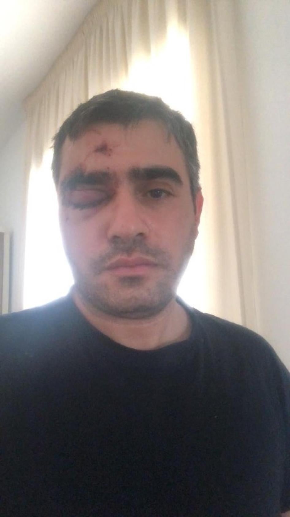 Rabie Barakat was struck in the head with a teargas cartridge, causing a fracture around his right eye, internal bleeding in the eye, and some bleeding in his brain.