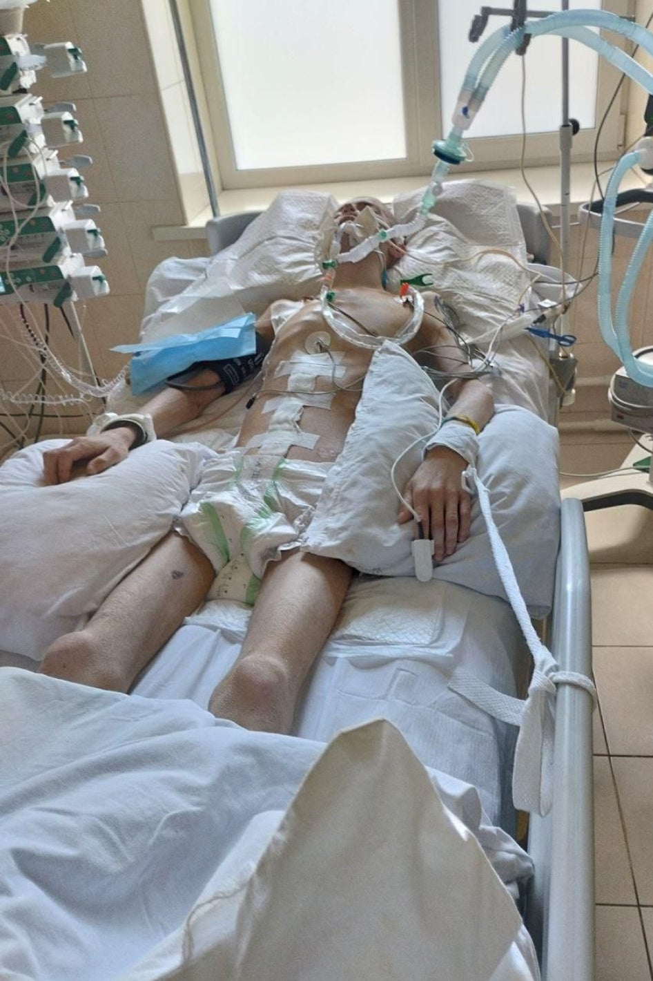 Artur Reutov, un soldat ukrainien détenu pendant trois ans par les forces russes, photographié dans un hôpital peu après sa libération en mai 2025, dans le cadre d’un échange de prisonniers entre les deux pays.