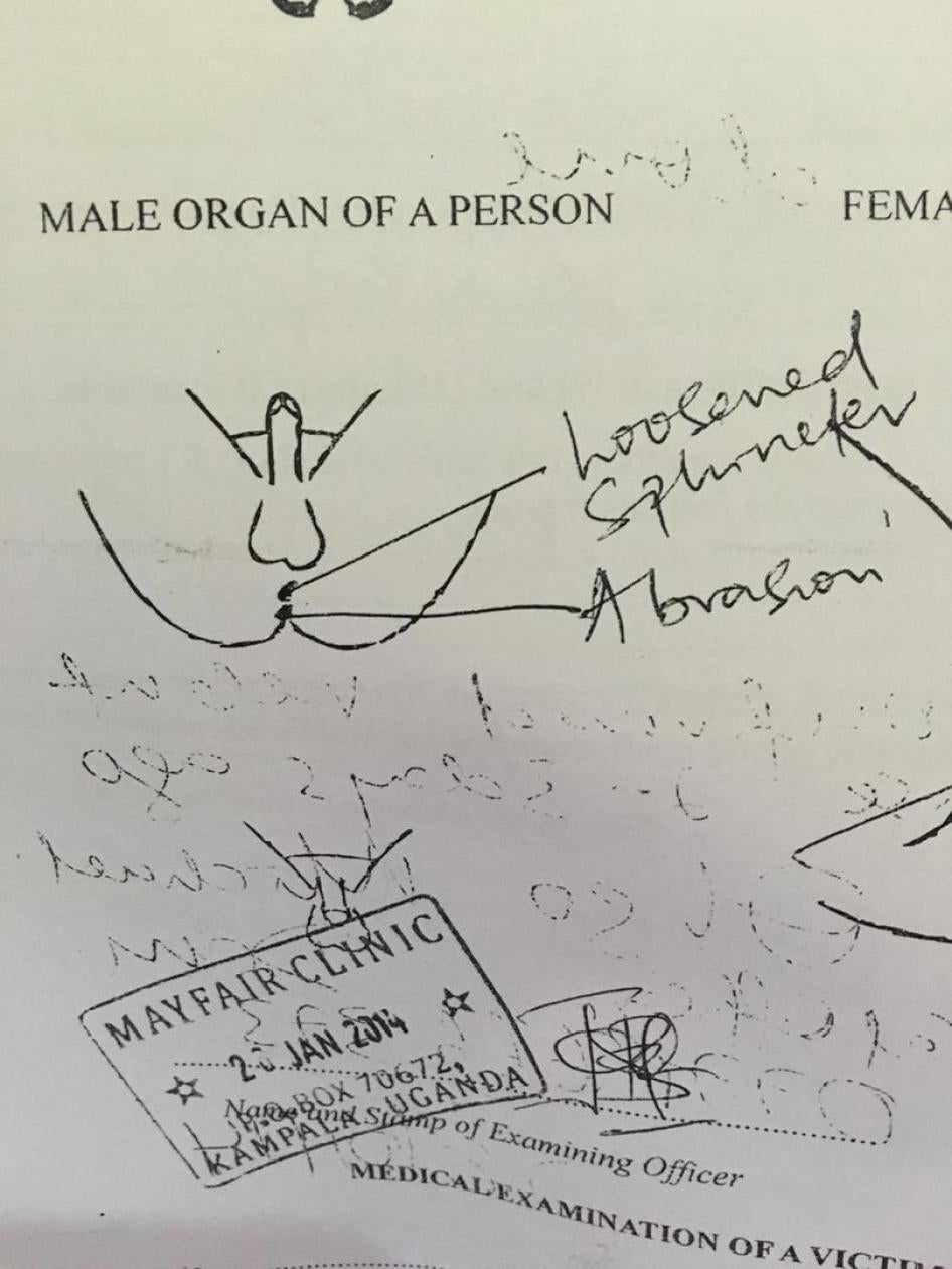 anal exam from Uganda 