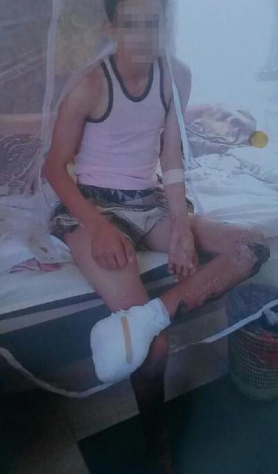 MENA ARMS Yemen Landmines Sept 2016 photo-3 arabic