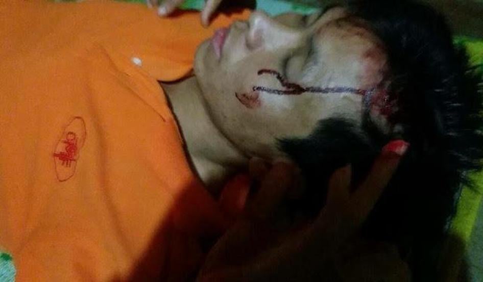 Trần Minh Nhật sau khi bị hành hung ở Lâm Đồng ngày 22 tháng Hai năm 2016.