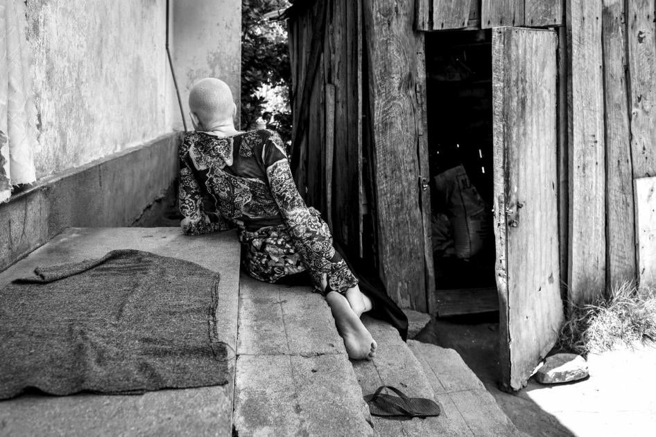 A girls with albinism seets on steps, she is seen from the back