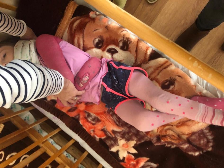 A young girl whose arms were tied and affixed behind her back in a closed children's institution.