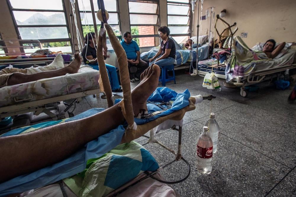 Devices pieced together by doctors, using recycled soda bottles and water jugs as weights, to treat patients with broken legs at the University Hospital Dr. Luis Razetti in Barcelona, April 15, 2016. 