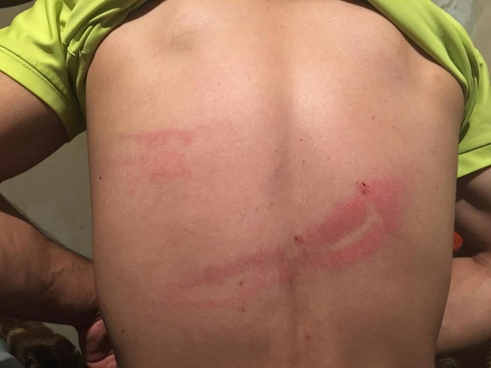 Unidentified men cooperating with Armenian police beat cameraman David Harutyunyan with a wooden club and destroyed his video camera as he filmed the violent police dispersal in the Erebuni district of Yerevan on July 29, 2016. 