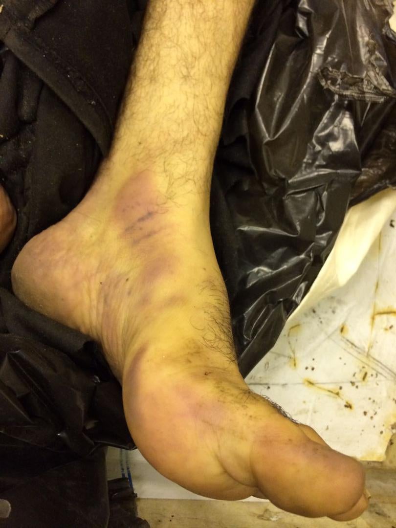 Photos of the bodies of three of the Syrians who died in military custody,