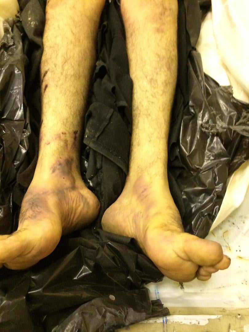 Photos of the bodies of three of the Syrians who died in military custody,