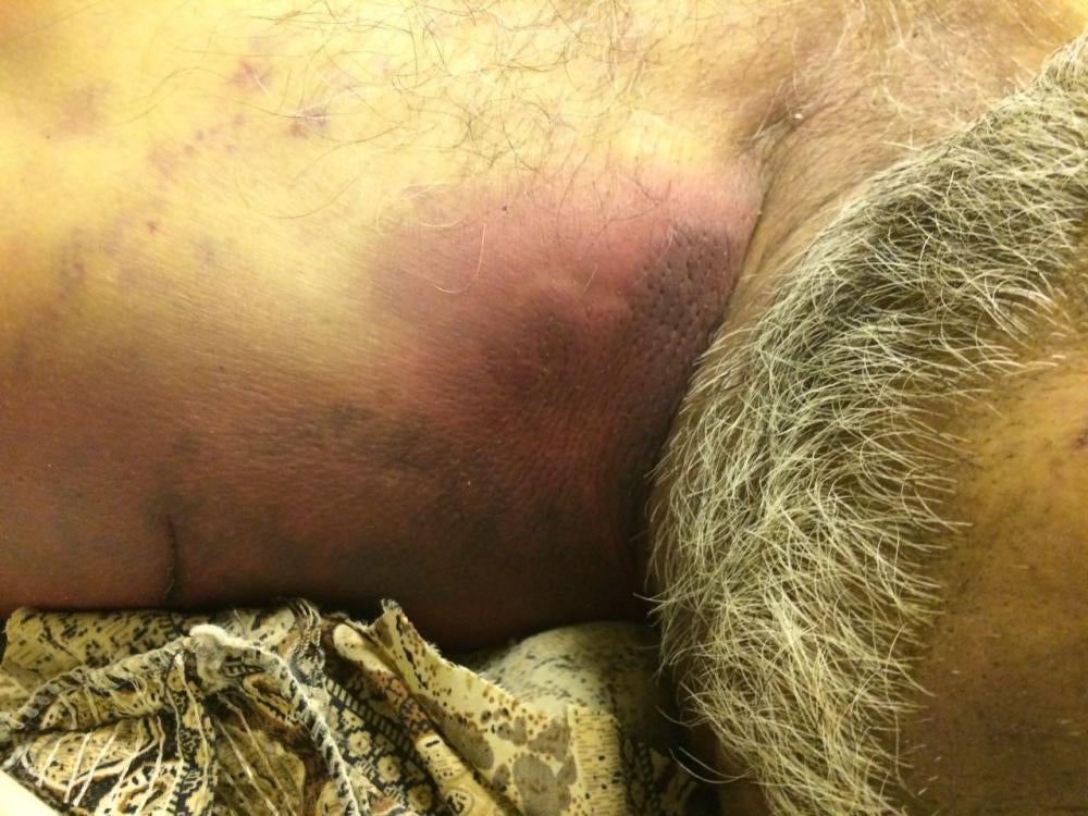 Photos of the bodies of three of the Syrians who died in military custody.