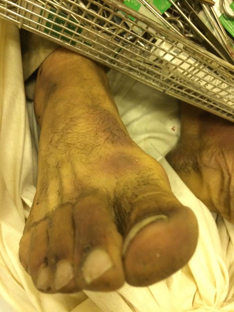 Photos of the bodies of three of the Syrians who died in military custody.