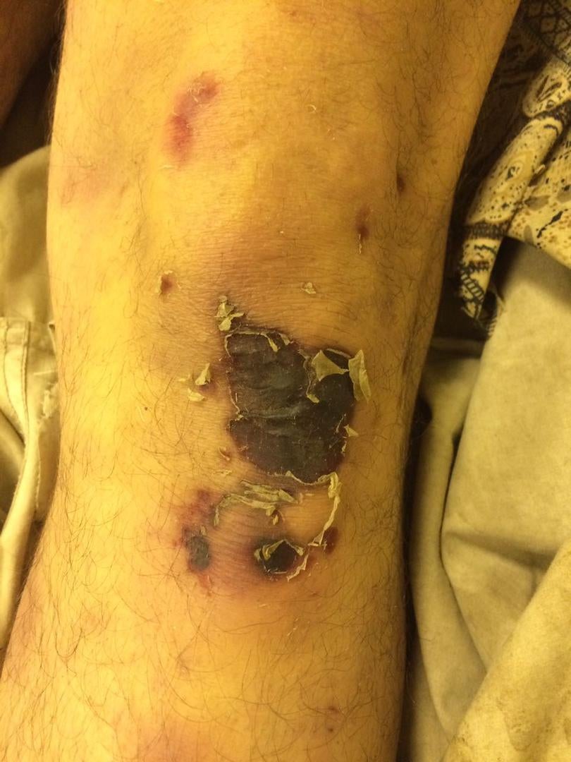 Photos of the bodies of three of the Syrians who died in military custody,