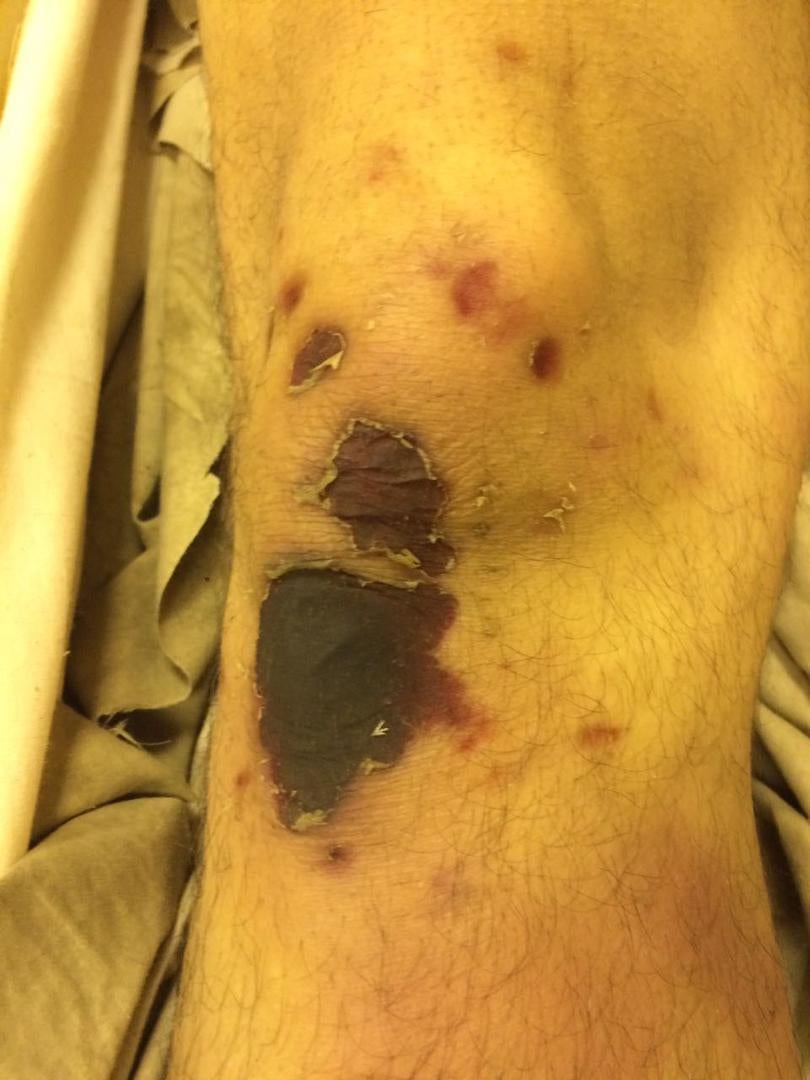 Photos of the bodies of three of the Syrians who died in military custody,