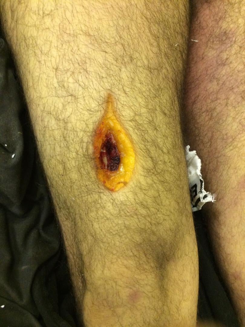 Photos of the bodies of three of the Syrians who died in military custody,