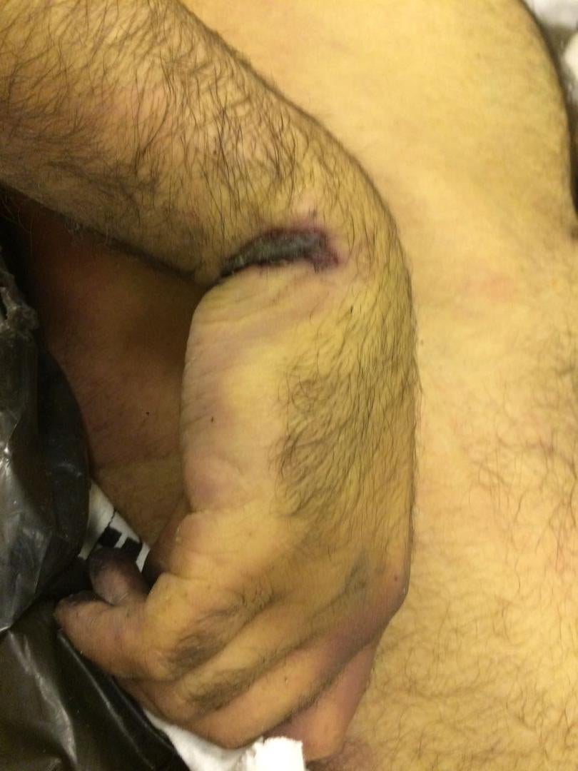 Photos of the bodies of three of the Syrians who died in military custody,