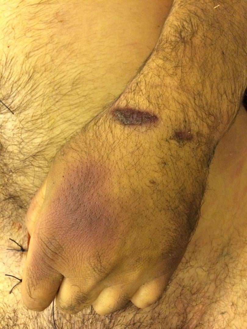 Photos of the bodies of three of the Syrians who died in military custody,