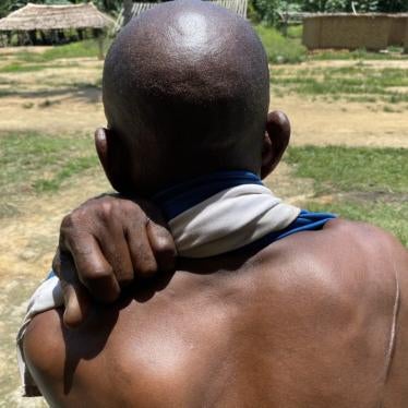 An Indigenous Iyeke man shows a scar from a machete wound in Sambwakoy, Tshuapa province, Democratic Republic of Congo, October 2021. 