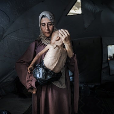Eighteen-month-old Muhammad Zakariya Ayyoub al-Matouq faces life-threatening malnutrition as the humanitarian situation worsens due to ongoing Israeli attacks and the blockade in Gaza City, Gaza, July 21, 2025. 