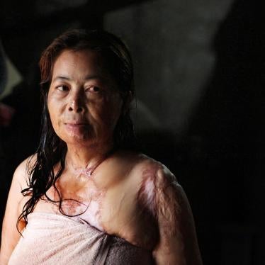 Chantheoun, the victim of an acid attack in Phnom Penh, Cambodia in September 1997. 